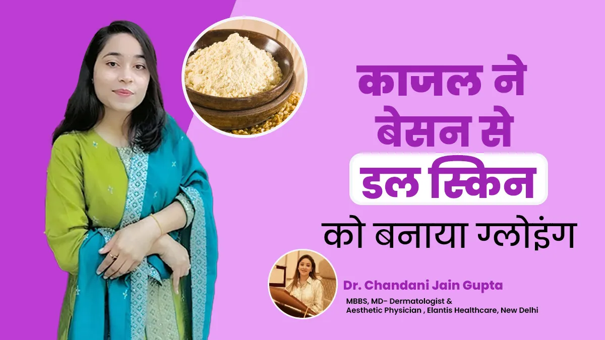 डल स्किन से परेशान थीं काजल सेंगर, रोजाना बेसन से चेहरा धोकर स्किन को बनाया ग्लोइंग