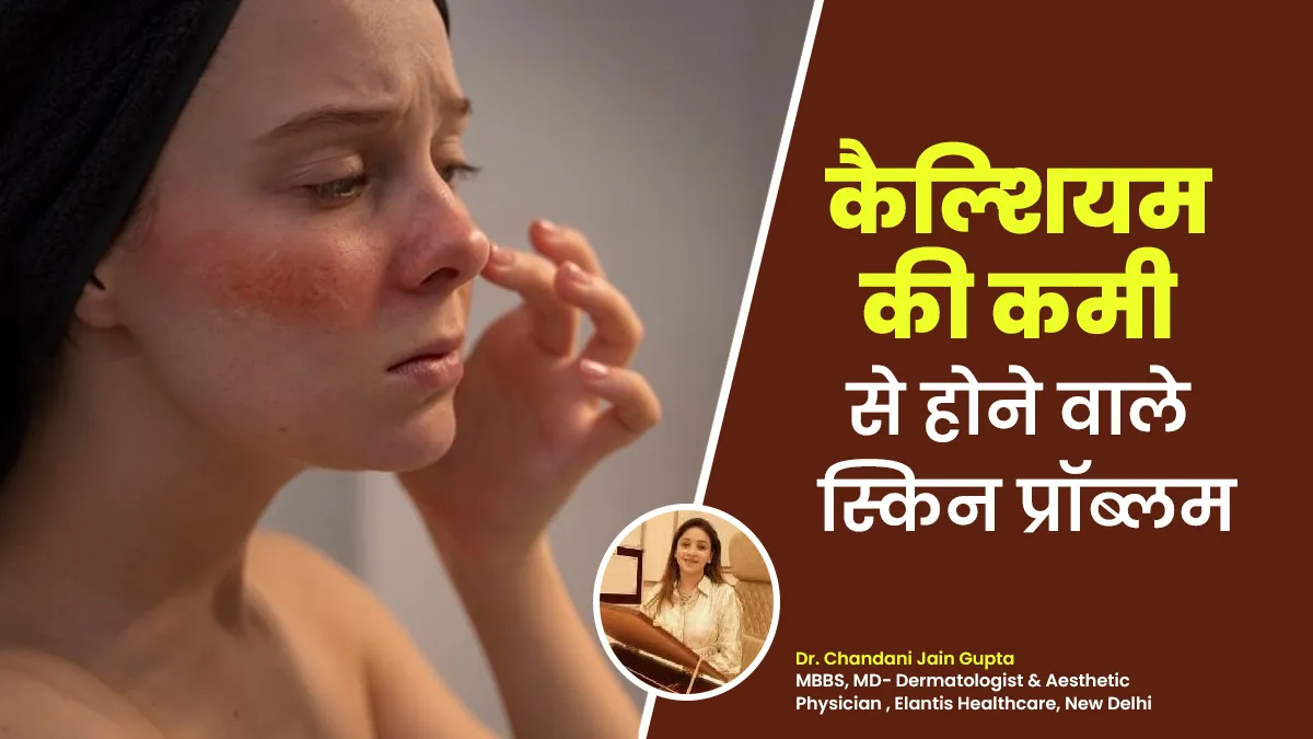 कैल्शियम की कमी के कारण हो सकती हैं ये 5 स्किन प्रॉब्लम, डॉक्टर से जानें