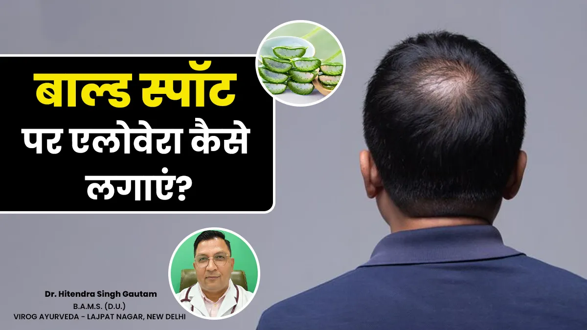 सिर में जगह-जगह से उड़ रहे हैं बाल तो लगाएं एलोवेरा जेल, जानें कैसे करें इस्तेमाल
