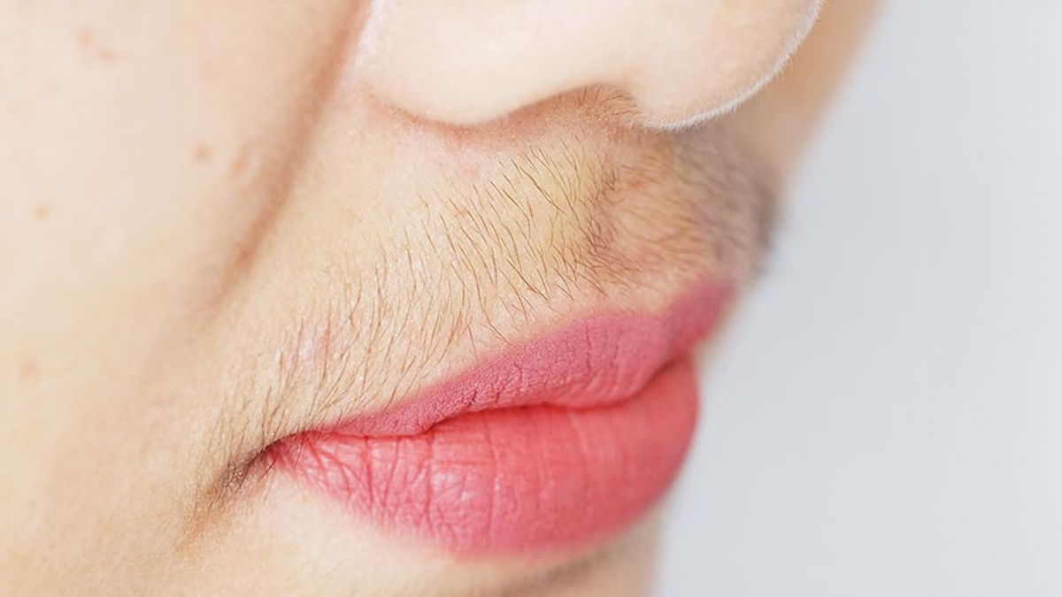 Hirsutism In Women In Hindi causes-of-hirsutism-in-women-main