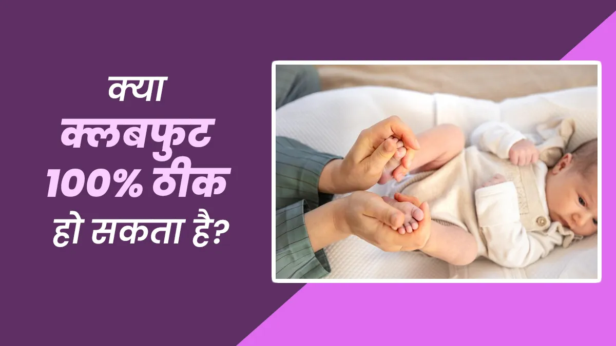 क्या क्लबफुट पूरी तरह से ठीक हो सकता है? जानें डॉक्टर से