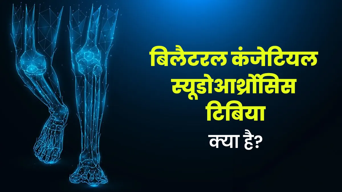 जन्मजात दोनों पैरों में होती है ये बीमारी, जानें स्यूडोआर्थ्रोसिस टिबिया का कारण और लक्षण