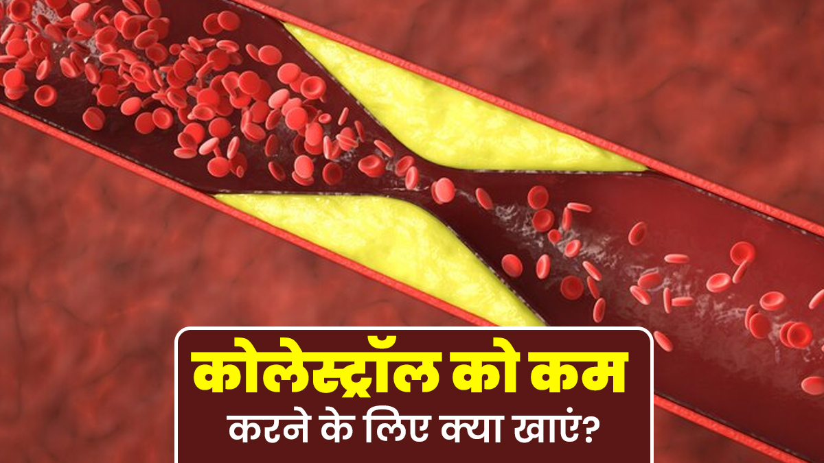 कोलेस्ट्रॉल कम करने के लिए क्या खाएं? एक्सपर्ट से जानें 7 फायदेमंद फूड्स