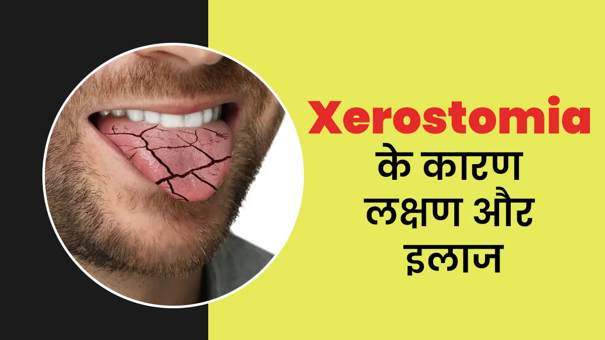 मुंह सूखने की बीमारी को कहते हैं जेरोस्टोमिया, जानें इसके कारण लक्षण और इलाज