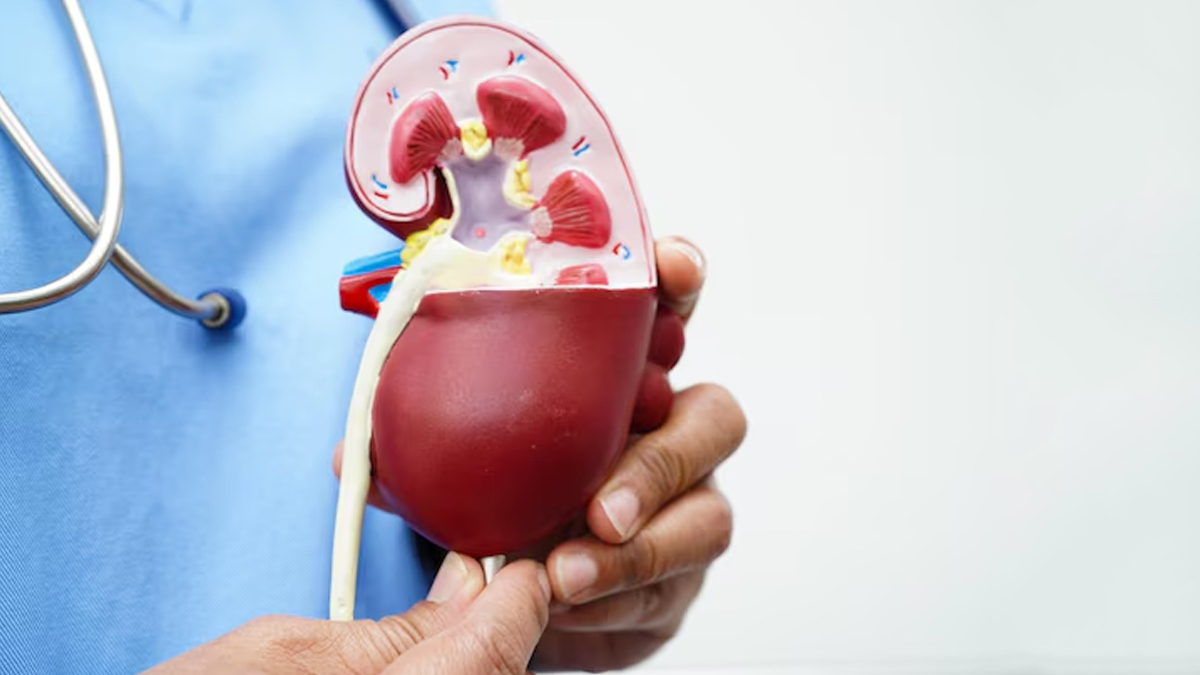 Kidney Transplant Fail