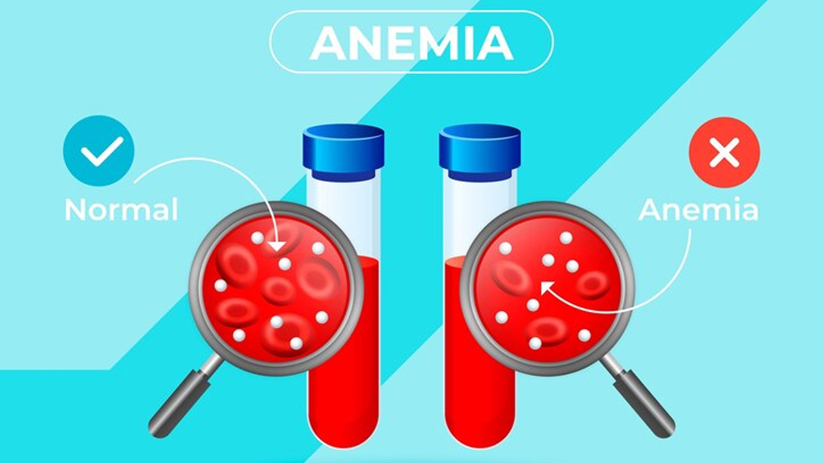 anemia-symptoms