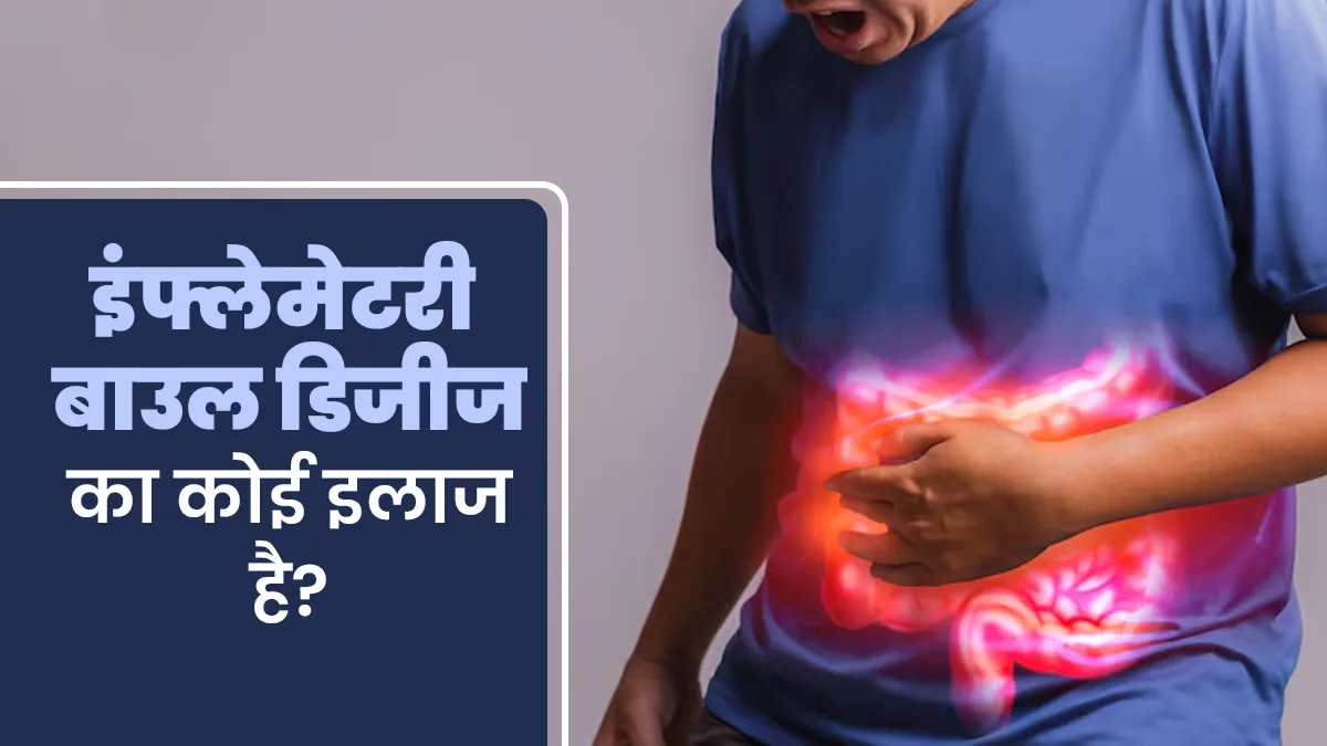 क्या इंफ्लेमेटरी बाउल डिजीज (IBD) का कोई इलाज है? जानें डॉक्टर से
