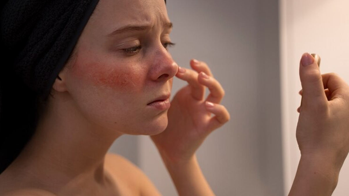 skin-sensitivity-before-holi