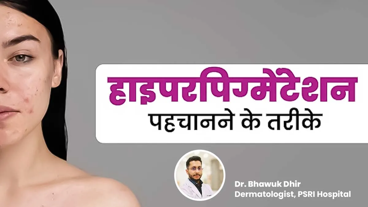 क्या आपके चेहरे पर डार्क स्पॉट्स हैं? जानें हाइपरपिग्मेंटेशन पहचानने के तरीके