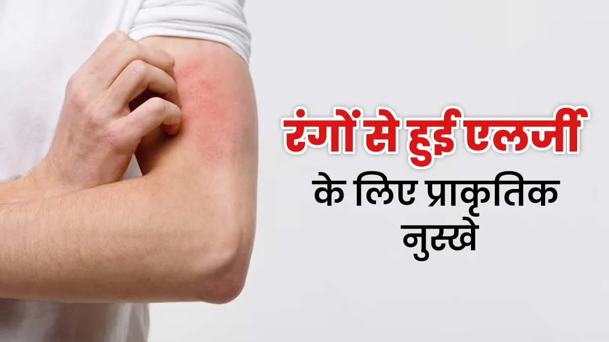 होली के रंगों से हो गई है एलर्जी? इससे राहत पाने के लिए ट्राई करें ये 5 प्राकृतिक नुस्खे