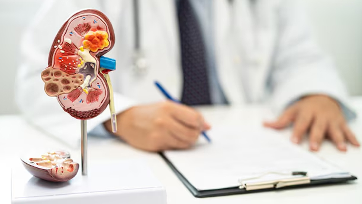 Causes Of Kidney Transplant Fail