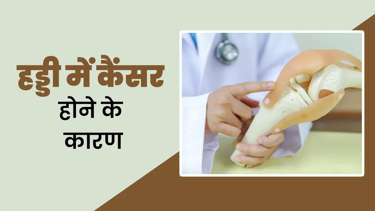 हड्डी में कैंसर होने के पीछे हो सकते हैं ये 4 कारण, जानें कैसे करें पहचान
