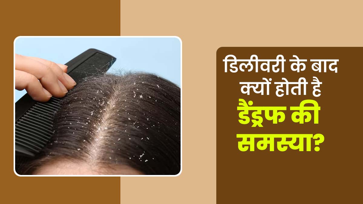डिलीवरी के बाद क्यों होती है डैंड्रफ की समस्या? एक्सपर्ट से जानें कारण और बचाव के उपाय