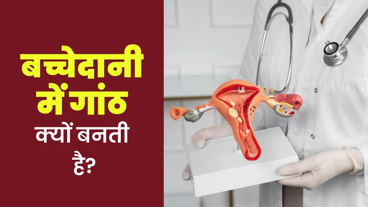 बच्चेदानी में गांठ क्यों बनती है? डॉक्टर से जानें कारण