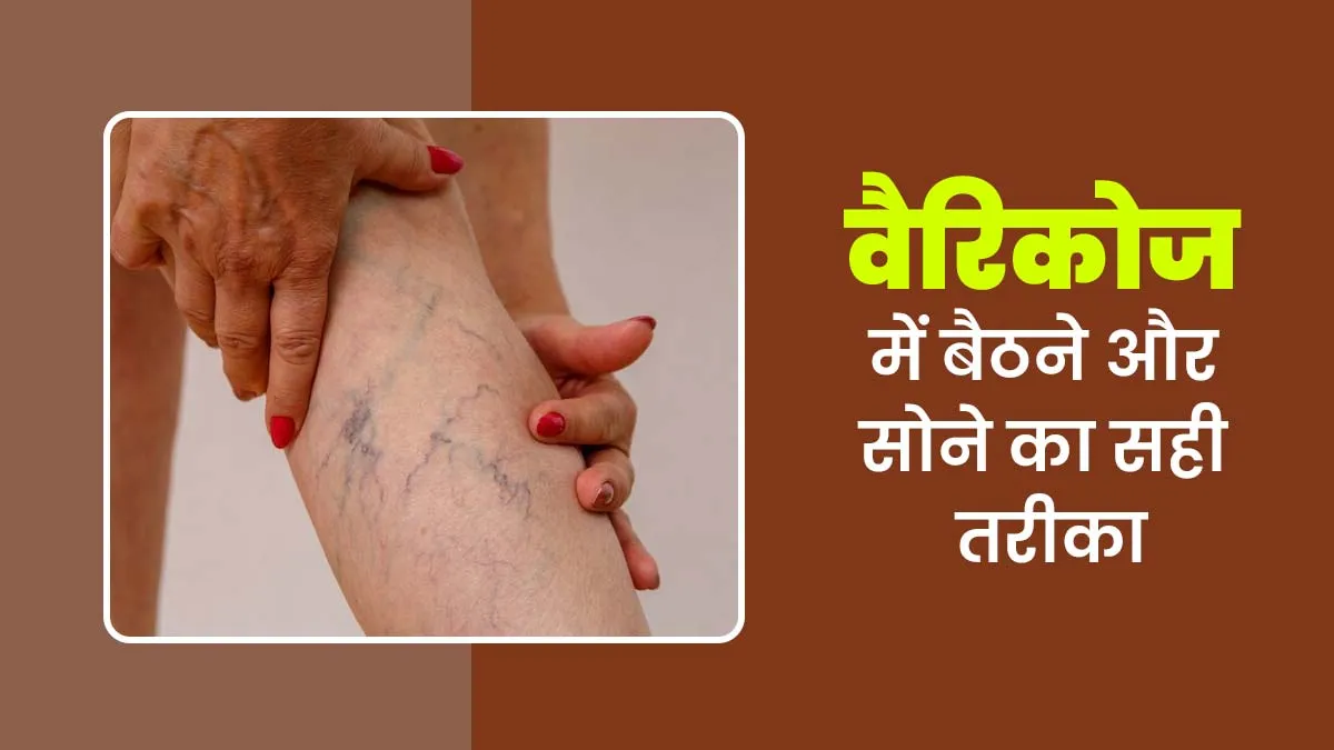 वैरिकोज वेन्स की समस्या में बैठने और सोने का सही तरीका, एक्सपर्ट से जानें