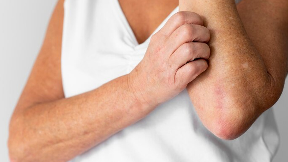 can-menopause-cause-itchy-skin-in