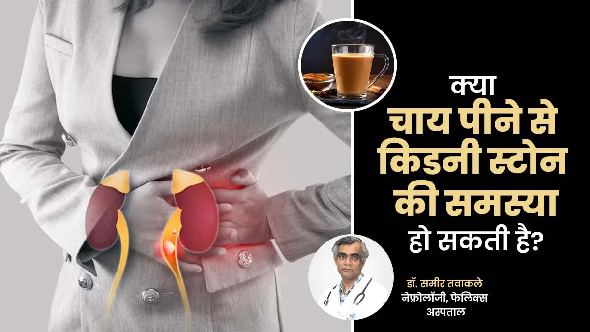 क्या चाय पीने से किडनी की पथरी हो सकती है? डॉक्टर से जानें