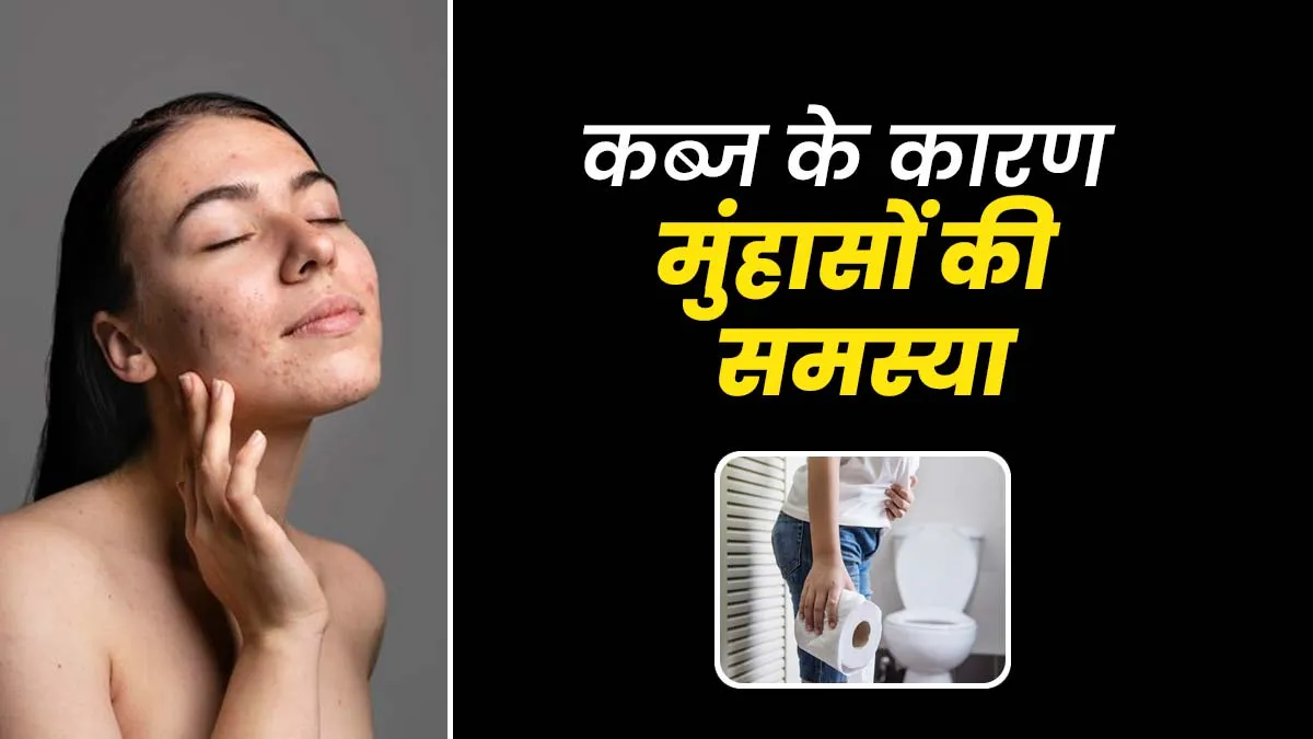 क्या कब्ज के कारण चेहरे पर मुंहासों की समस्या हो सकती है? एक्सपर्ट से जानें