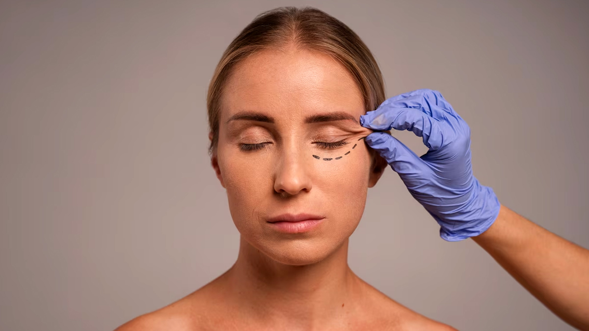 Effective Treatments For Eye Wrinkles