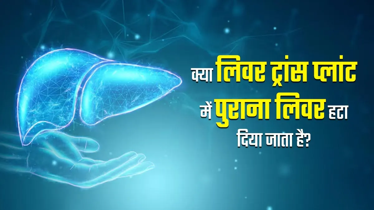 क्या लिवर ट्रांसप्लांट में पुराना लिवर हटा दिया जाता है? जानें डॉक्टर से