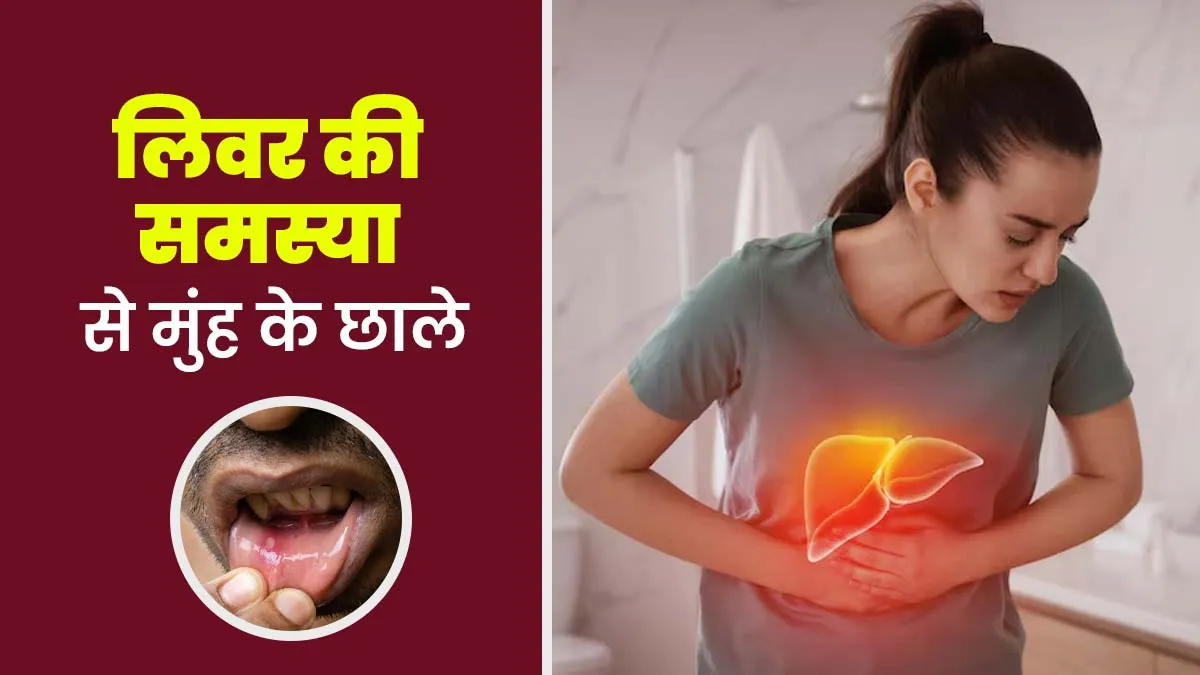 क्या लिवर की समस्या से मुंह में छाले हो सकते हैं? डॉक्टर से जानें कैसे लिवर से जुड़ी है आपकी ओरल हेल्थ