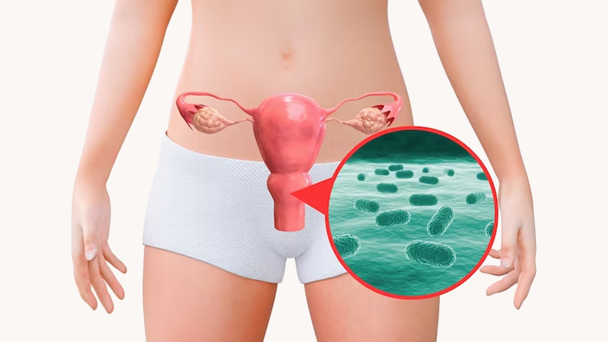 what happens if a yeast infection goes untreated 1 (1)