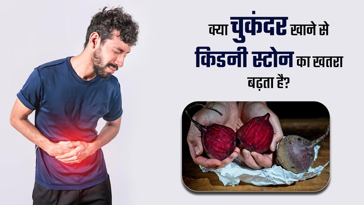 क्या वाकई चुकंदर खाने से किडनी की पथरी का खतरा बढ़ता है? जानें डॉक्टर से
