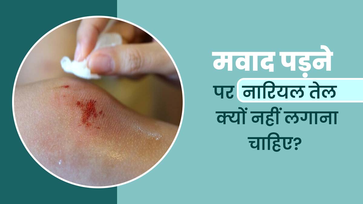 घाव में पस हो जाने पर नारियल तेल क्यों नहीं लगाना चाहिए? जानें आयुर्वेदाचार्य से
