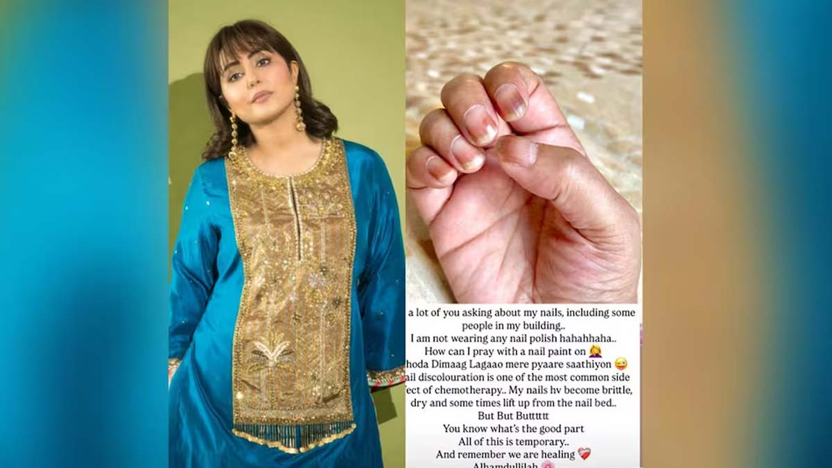 Hina-Khan-nail-discoloration-due-to-Chemotherapy-inside