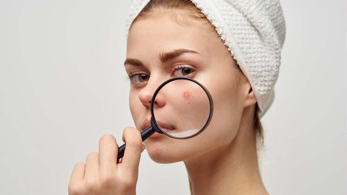 How-Constipation-Affects-your-skin-inside