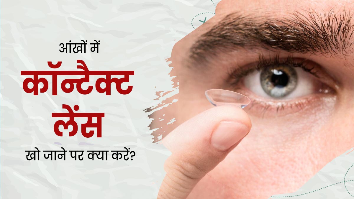 कॉन्टैक्ट लेंस आंखों के अंदर इधर-उधर चला जाए, तो क्या करें? डॉक्टर से जानें