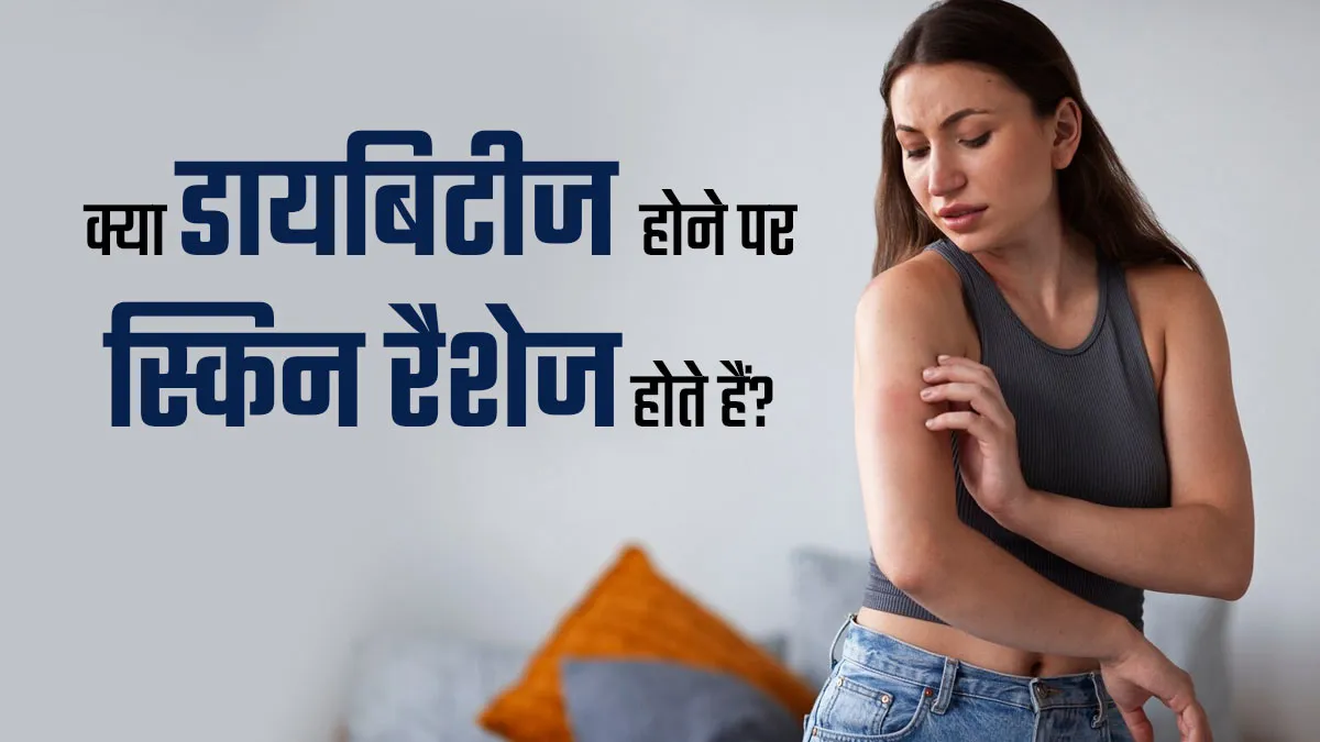 त्वचा पर रैशेज कहीं डायबिटीज का संकेत तो नहीं? डॉक्टर से जानें कैसे हैं एक-दूसरे से जुड़े