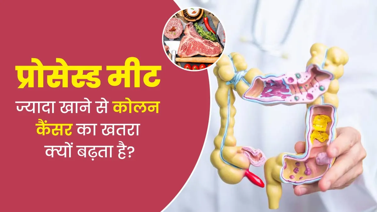 प्रोसेस्ड मीट ज्यादा खाने से कोलन कैंसर का खतरा क्यों बढ़ता है? डॉक्टर से जानें