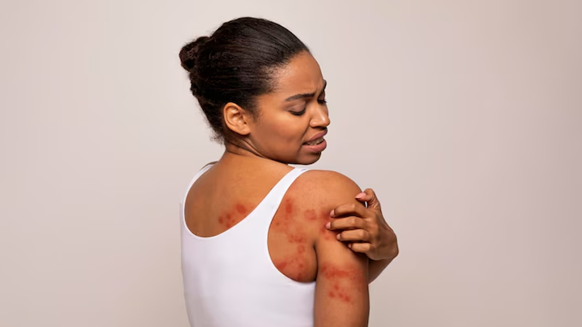 diabetesrashes-inside