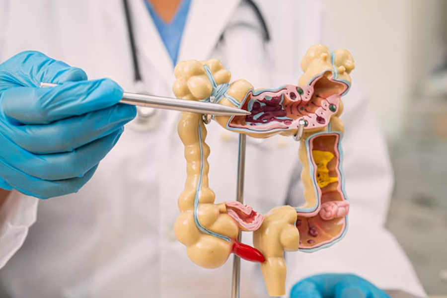 why does processed meat cause colon cancer in hindi 1