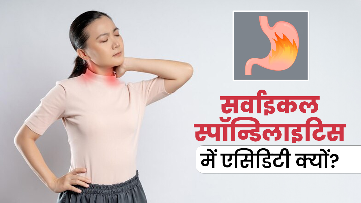 सर्वाइकल स्पॉन्डिलाइटिस में क्यों होती है ज्यादा एसिडिटी की समस्या? डॉक्टर से जानें