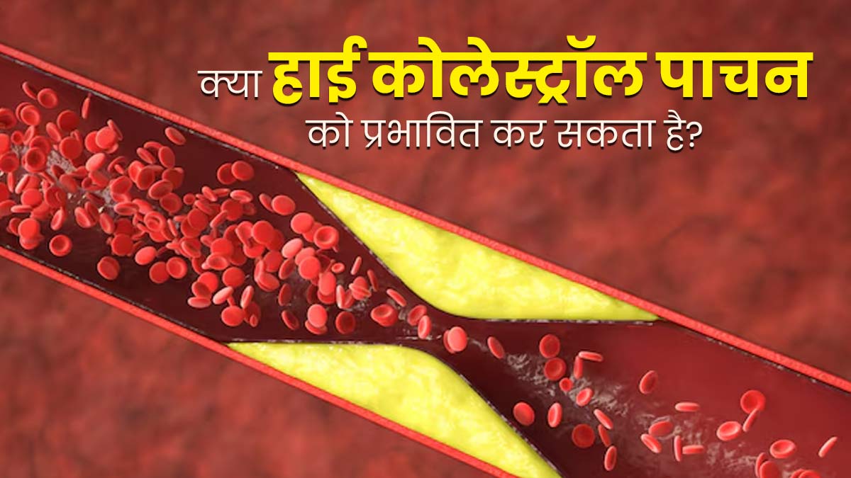 क्या हाई कोलेस्ट्रॉल पाचन को प्रभावित कर सकता है? डॉक्टर से जानें