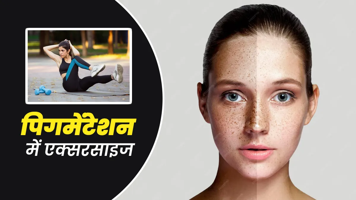 क्या एक्सरसाइज से पिगमेंटेशन दूर हो सकता है? स्किन एक्सपर्ट से जानें