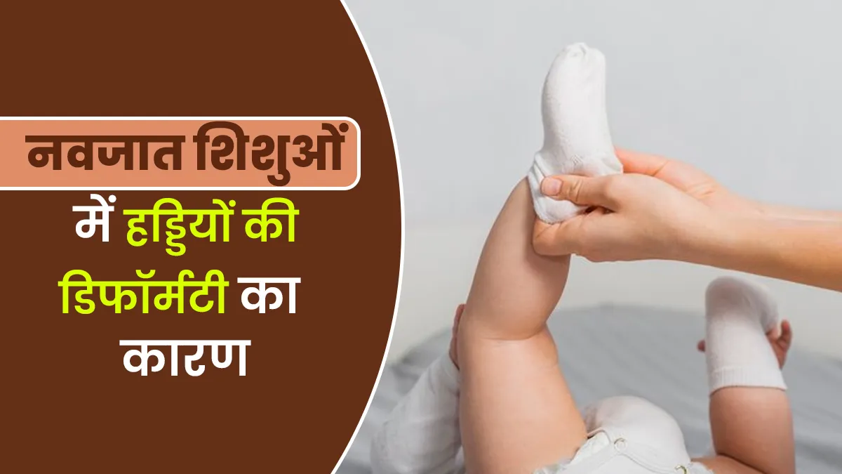 शिशुओं में जन्म से ही हड्डियों से जुड़ी समस्या होने के क्या कारण हो सकते हैं? डॉक्टर से जानें