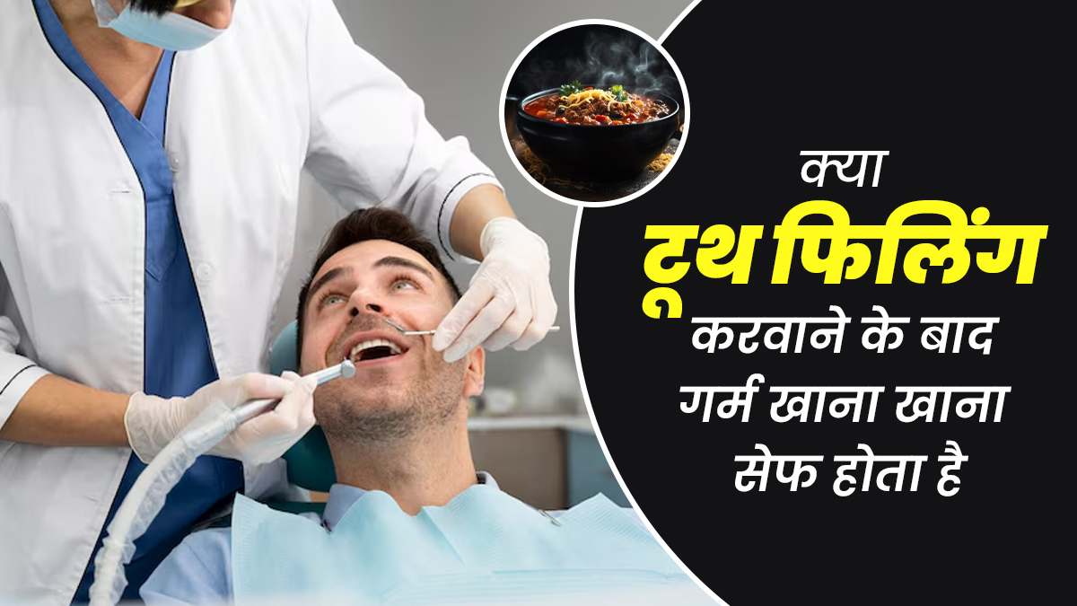 क्या दांतों की फिलिंग करवाने के बाद गर्म खाना खा सकते हैं? जानें डॉक्टर से