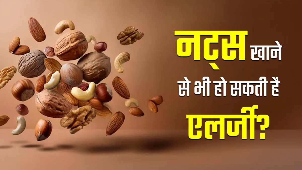नट एलर्जी होने के क्या कारण हो सकते हैं? डॉक्टर से जानें लक्षण और सावधानियां