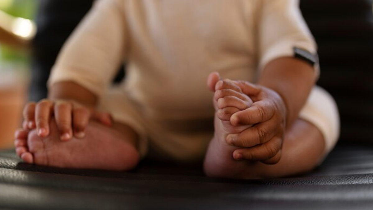 bone deformities in newborn