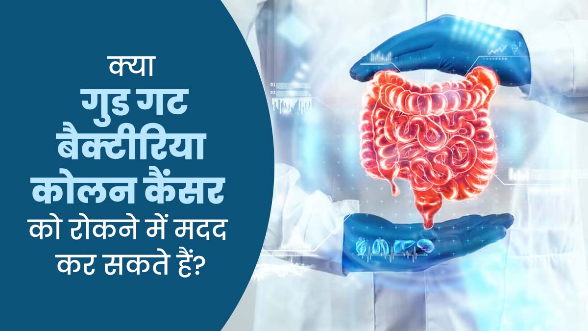 क्या आंतों के गुड बैक्टीरिया कोलन कैंसर को रोकने में मदद कर सकते हैं? डॉक्टर से जानें