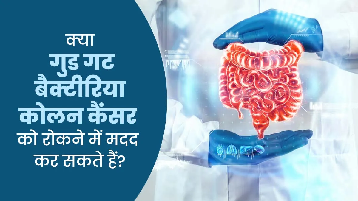 क्या आंतों के गुड बैक्टीरिया कोलन कैंसर को रोकने में मदद कर सकते हैं? डॉक्टर से जानें