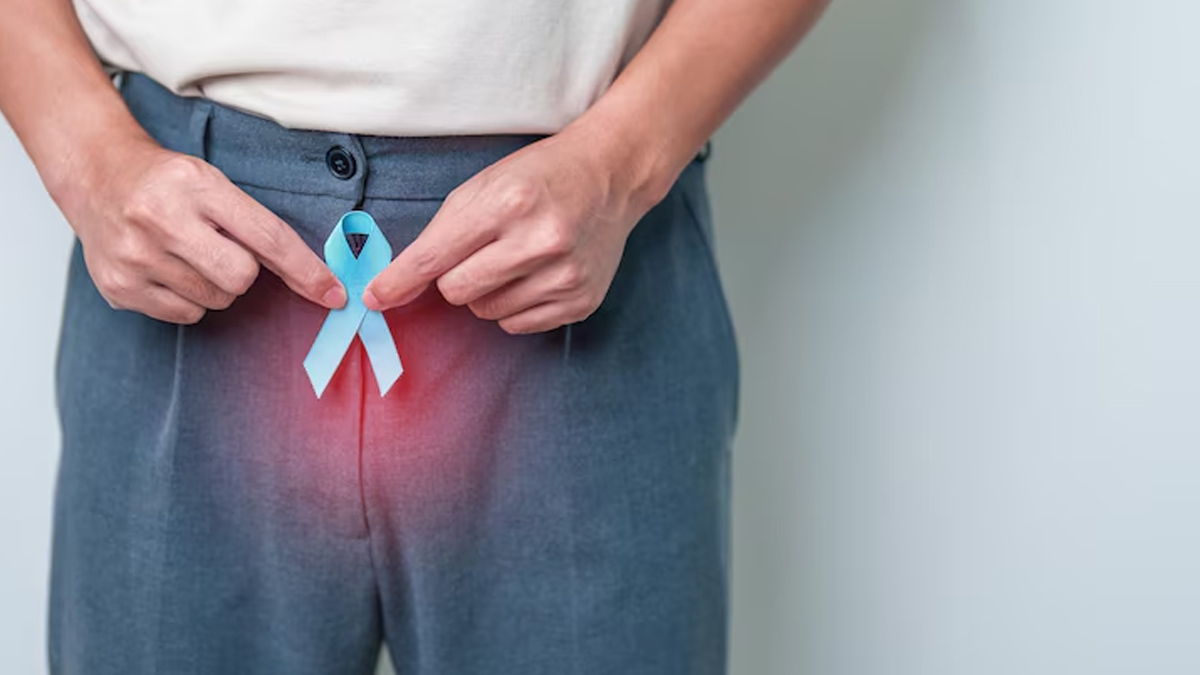 risk for prostate cancer 01 (3)