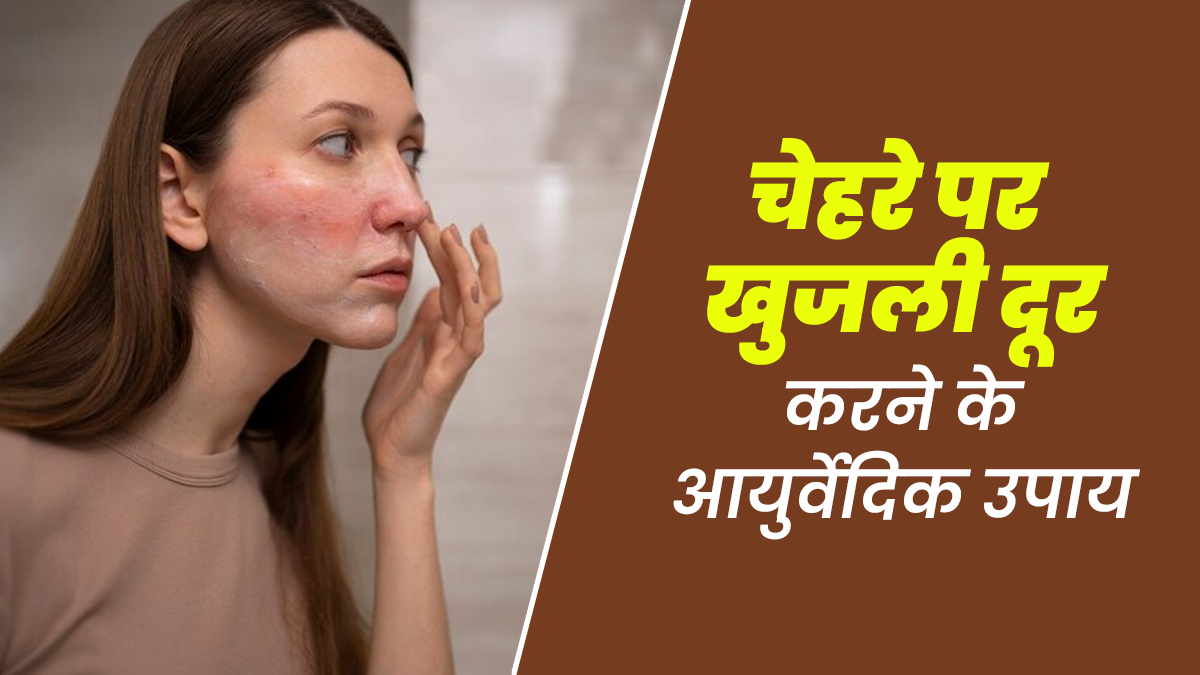 चेहरे पर खुजली से परेशान हैं? आयुर्वेद में बताए गए ये उपाय आजमाएं
