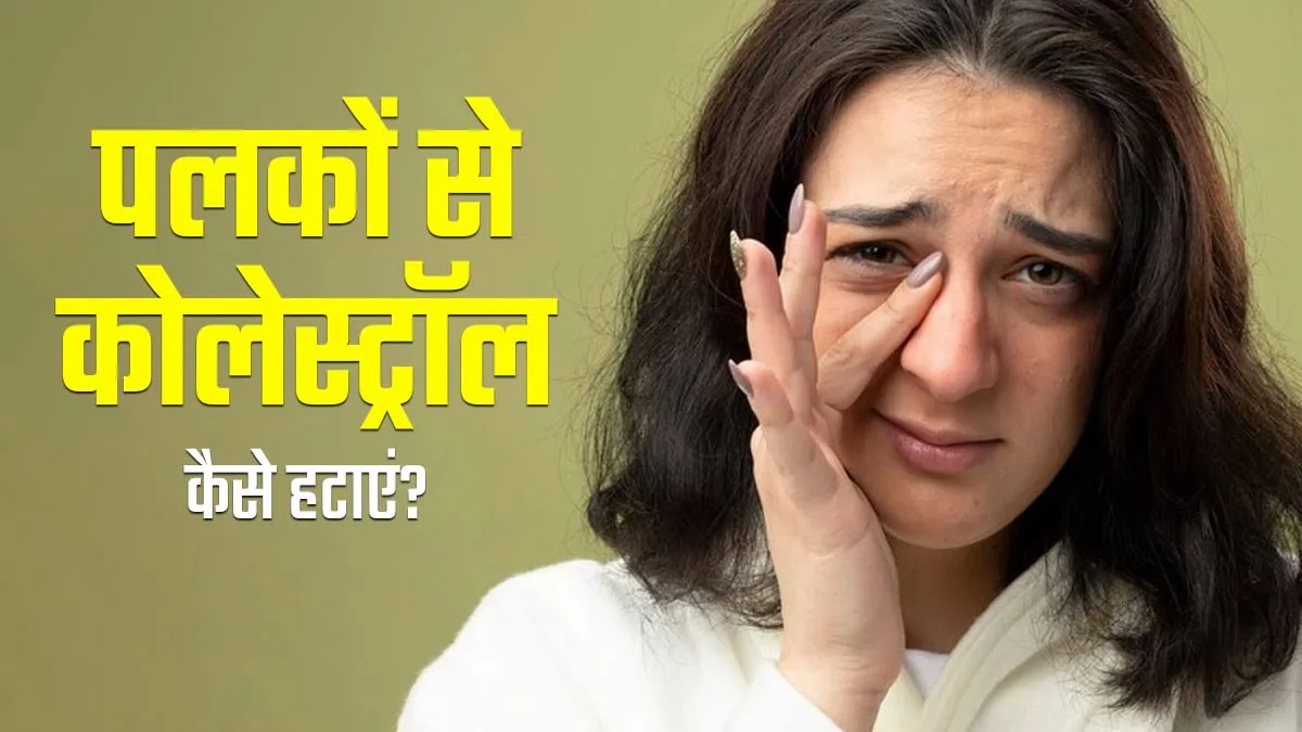 पलकों पर कोलेस्ट्रॉल जमा होने का इलाज क्या है? डॉक्टर से जानें