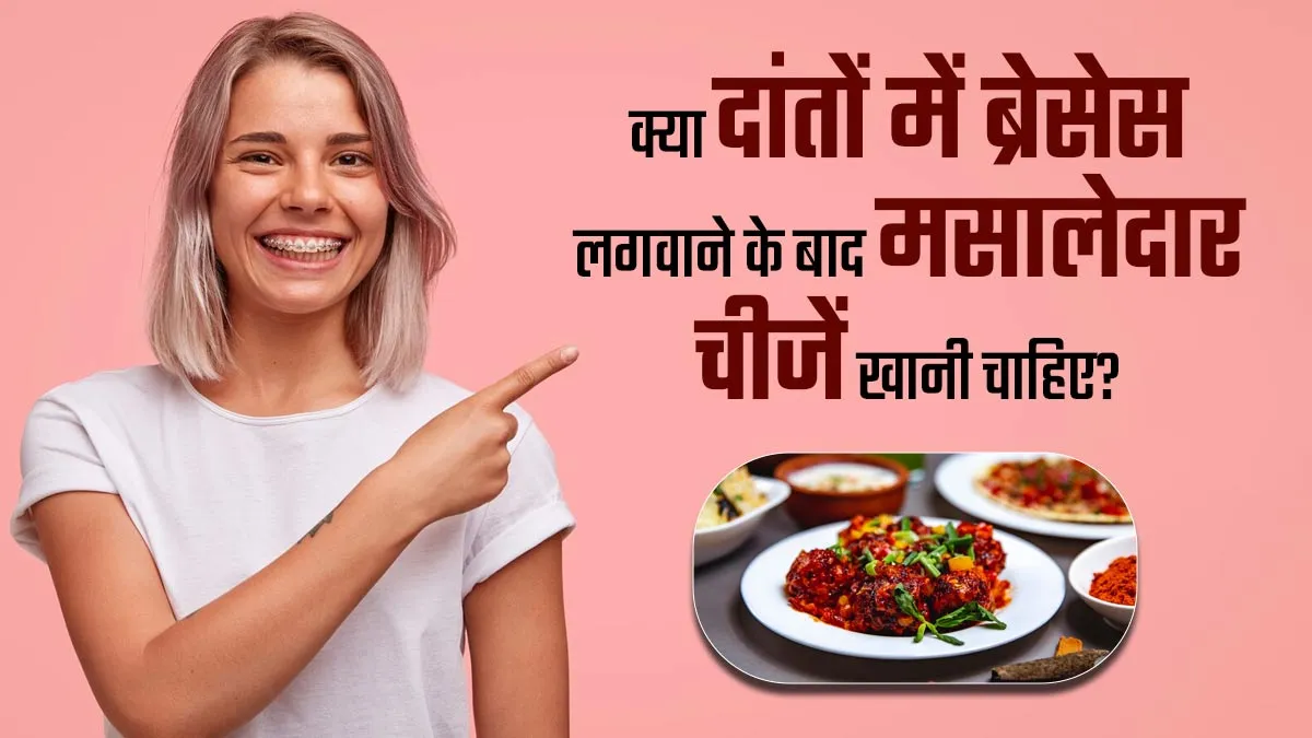 क्या दांतों में ब्रेसेस लगवाने के बाद मसालेदार चीजें खाना सही है? जानें डॉक्टर से