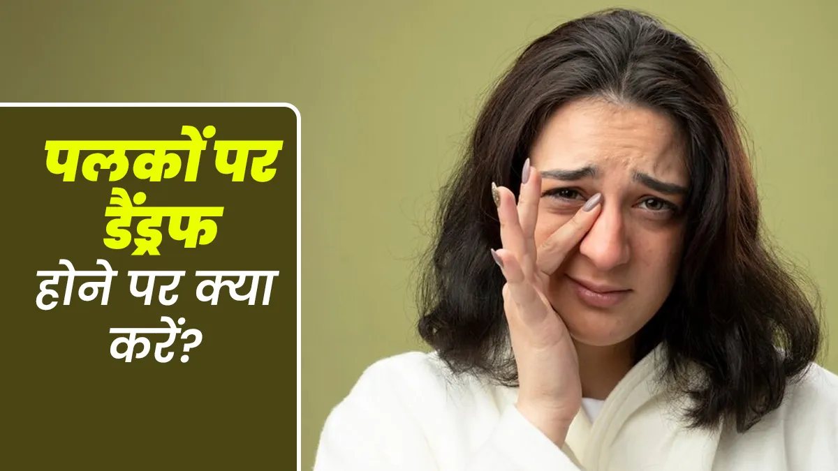 पलकों पर डैंड्रफ होने पर क्या करें? डॉक्टर से जानें कारण और बचाव