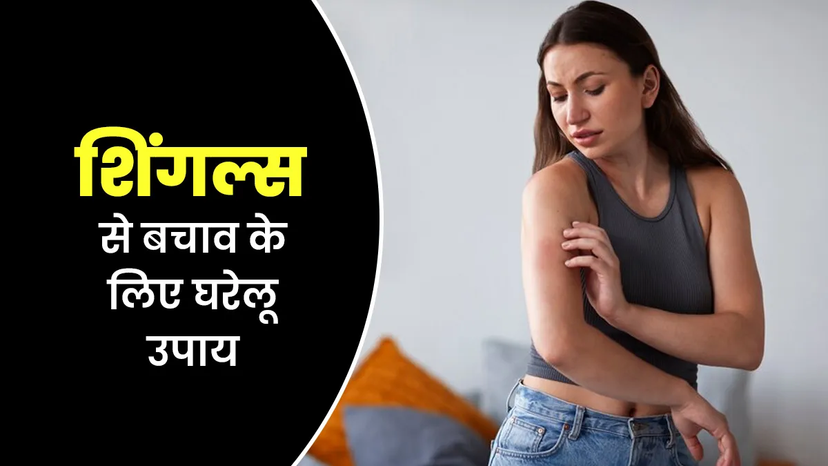 शिंगल्स के लिए कारगर हो सकते हैं डॉक्टर के बताए ये घरेलू उपाय